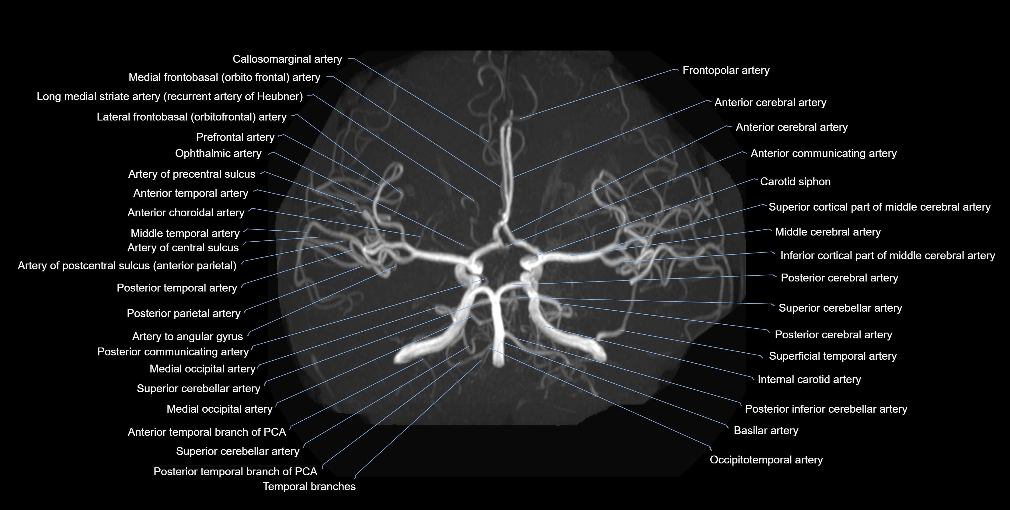 MRA brain axial MIP labelled  anatomy 3T MRI images -img-01021-00005.webp